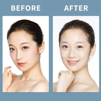 Makeup Remover - Bioaqua