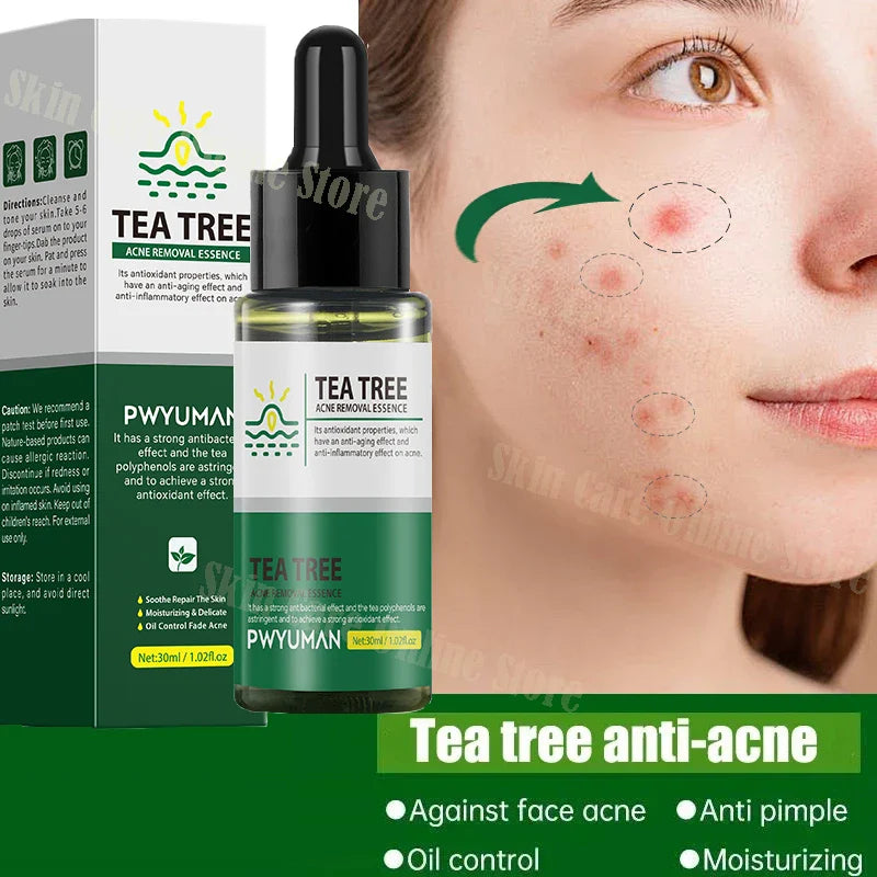 TEA TREE - Serum Acne Removal