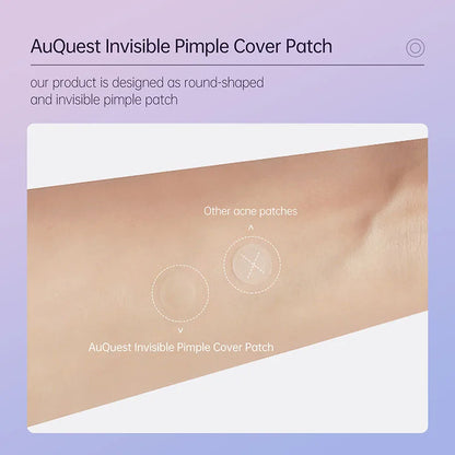 (BUY 1 GET 2) AUQUEST - Invisible Zit Patch