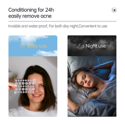 (BUY 1 GET 2) AUQUEST - Invisible Zit Patch